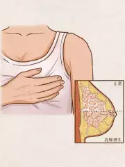 如何判断乳腺癌的分型？