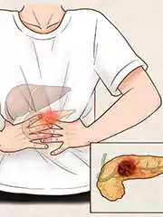 日本胰腺癌治疗：顶尖医院与创新技术