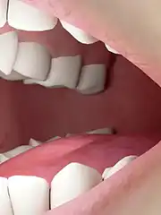 化疗副作用管理：口腔溃疡与恶心呕吐的预防与应对