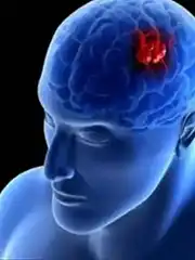 CAR-T杀疯了，致死率近100%的癌症患者生存期从11个月暴增3倍，肿瘤缩小率竟可达100%