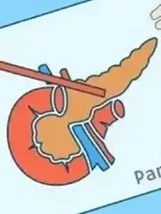 胰腺癌：肿瘤能否停止生长？探索治疗希望与未来